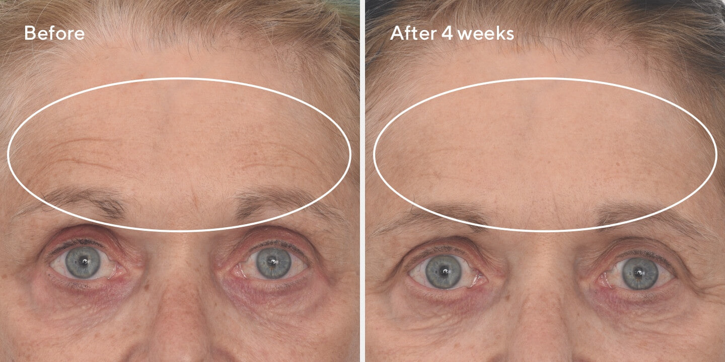 Murad Retinal Kit Facial Lifting, Reafirmante Y Antienvejecimiento.