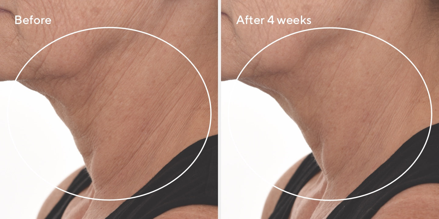 Murad Retinal Kit Facial Lifting, Reafirmante Y Antienvejecimiento.