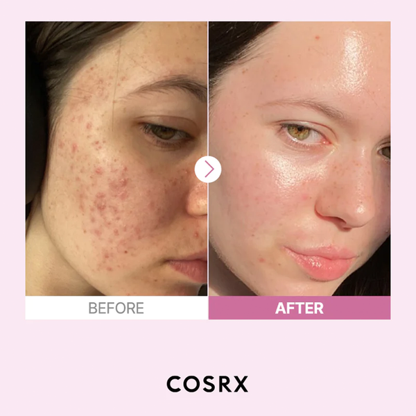 Kit Cuidado Facial Cosrx Retinol + Niacinamida + Nyx Gloss Voluminizador.