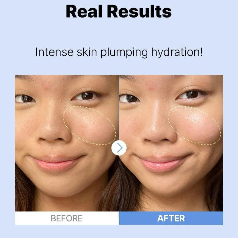 Cosrx Hyaluronic Acid 3 Serum.